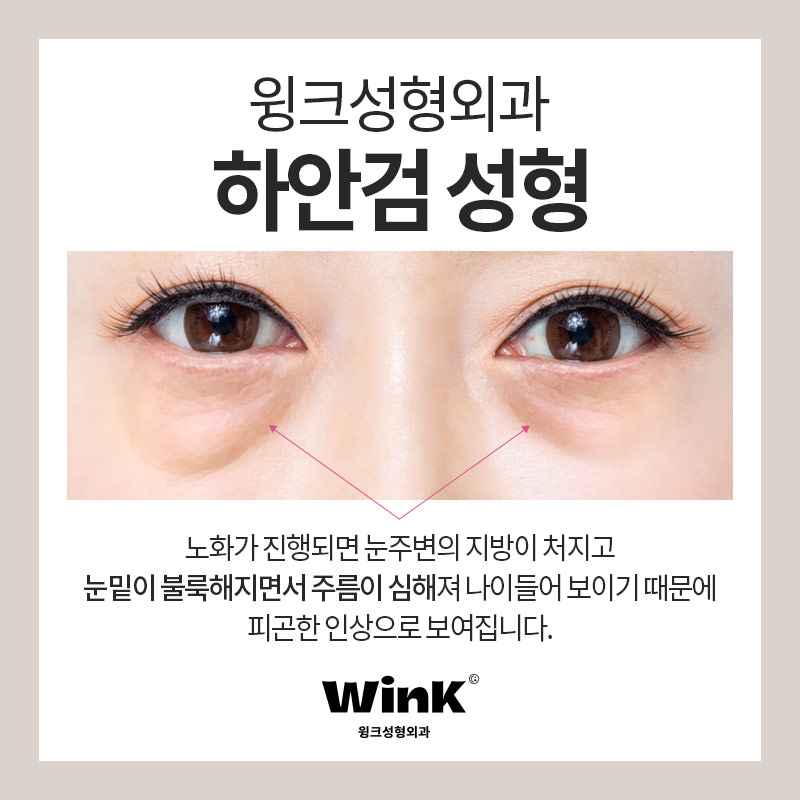 Wink Plastic Surgery Shin-Nonhyeon Station Lower Blepharoplasty for a Vibrant, Bright, Youthful Eye Appearance image 2