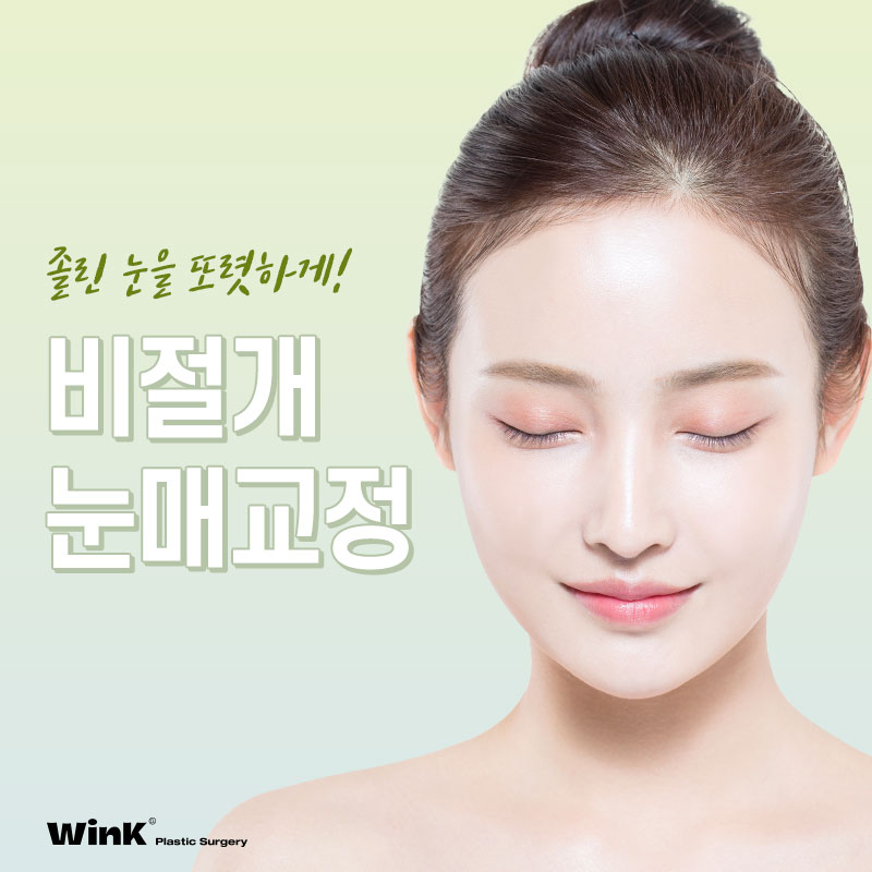 Sinsa Station Eye Correction Review | Sinsa Eye Correction Specialist | Wink Plastic Surgery | Non-Incisional Eye Correction image 1