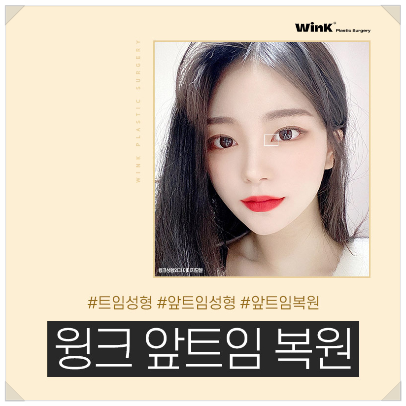앞트임복원회복기간 앞트임복원후기 윙크성형외과 신사앞트임복원후기 앞트임부작용 관련 이미지 1