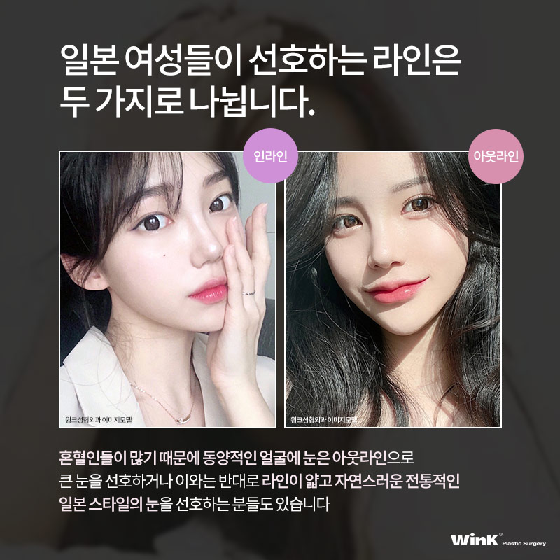 Coming to Korea from Japan for Plastic Surgery? WinK Plastic Surgery Explains the Japanese Double-Eyelid Line Preferred by Japanese Women! image 3