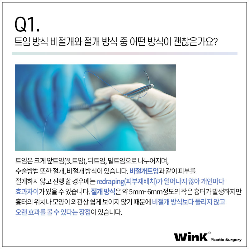 윙크성형외과에서 알려드리는 트임에 관한 모든 것! 관련 이미지 2