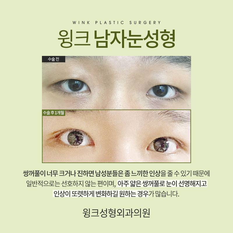 Male Eye Surgery: How Is It Best Done? image 4