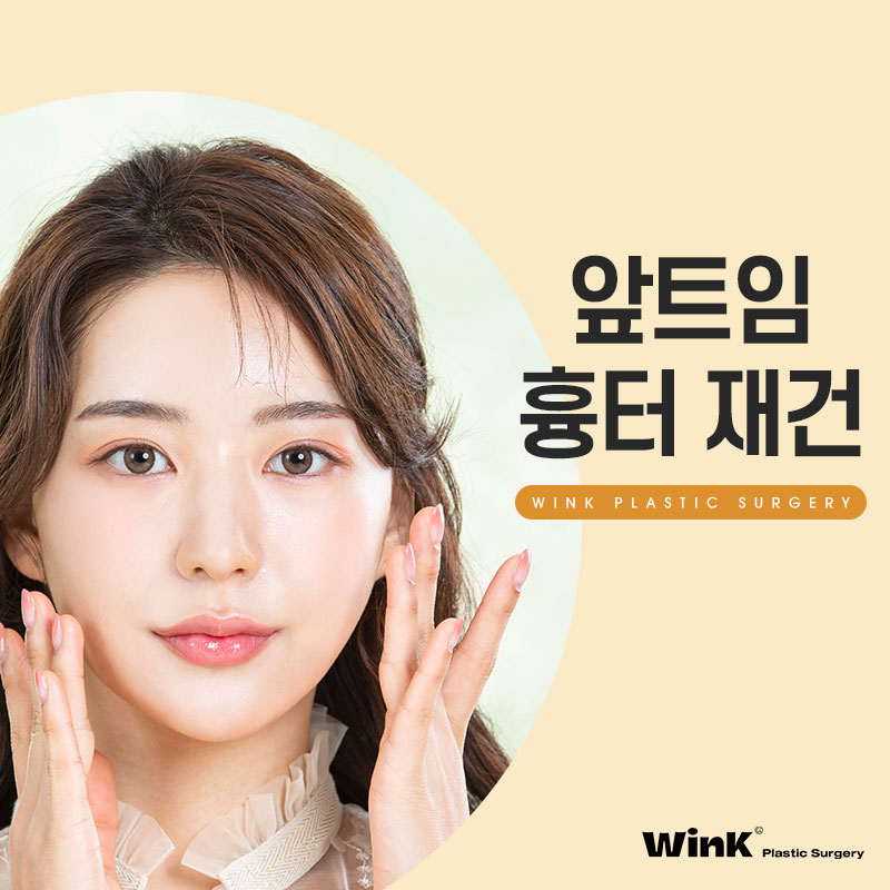 Canthal scar after epicanthoplasty? Learn about epicanthoplasty scar reconstruction with Wink Plastic Surgery. image 1