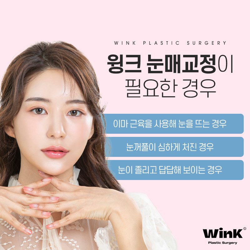 Wink Plastic Surgery Eye Correction for a Natural Look That Doesn't Stand Out image 3
