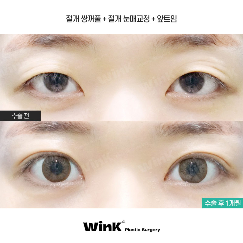 적절한 눈동자 노출로 더욱더 또렷한 눈매로! 관련 이미지 1