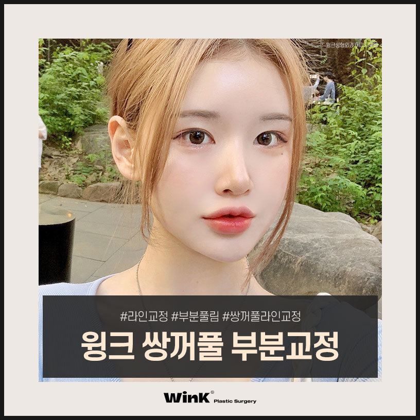 쌍꺼풀부분교정 쌍꺼풀부분절개수술 윙크성형외과 쌍수부분절개 신사쌍커풀수술 관련 이미지 4