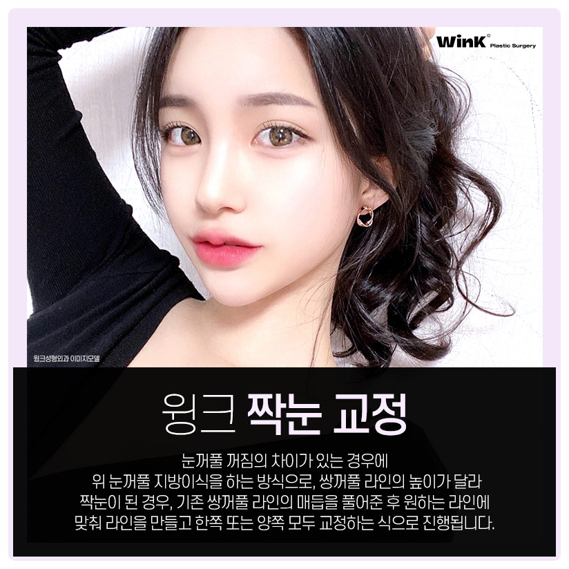 If You’re Looking Into Uneven Eye Correction Reviews: Wink Plastic Surgery, Uneven Eye Correction, Uneven Double Eyelid Surgery, Uneven Eyes image 3