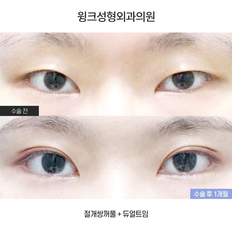 시원하면서도 부드러운 눈매로 만들어주는 듀얼트임 관련 이미지 1