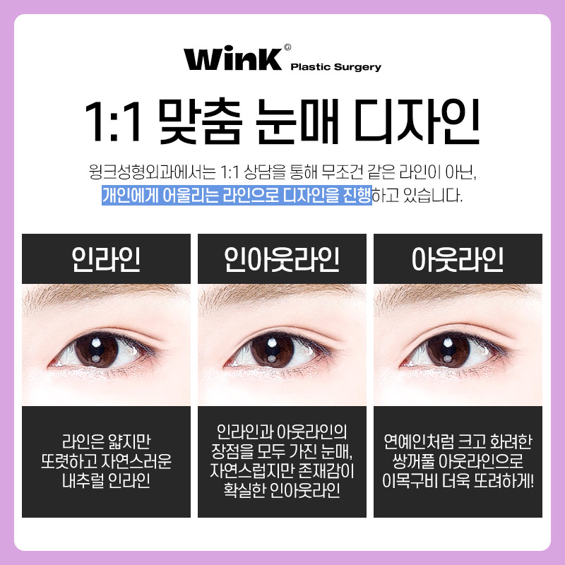 신사역쌍수잘하는곳? 윙크성형외과 자연유착쌍꺼풀후기 관련 이미지 4