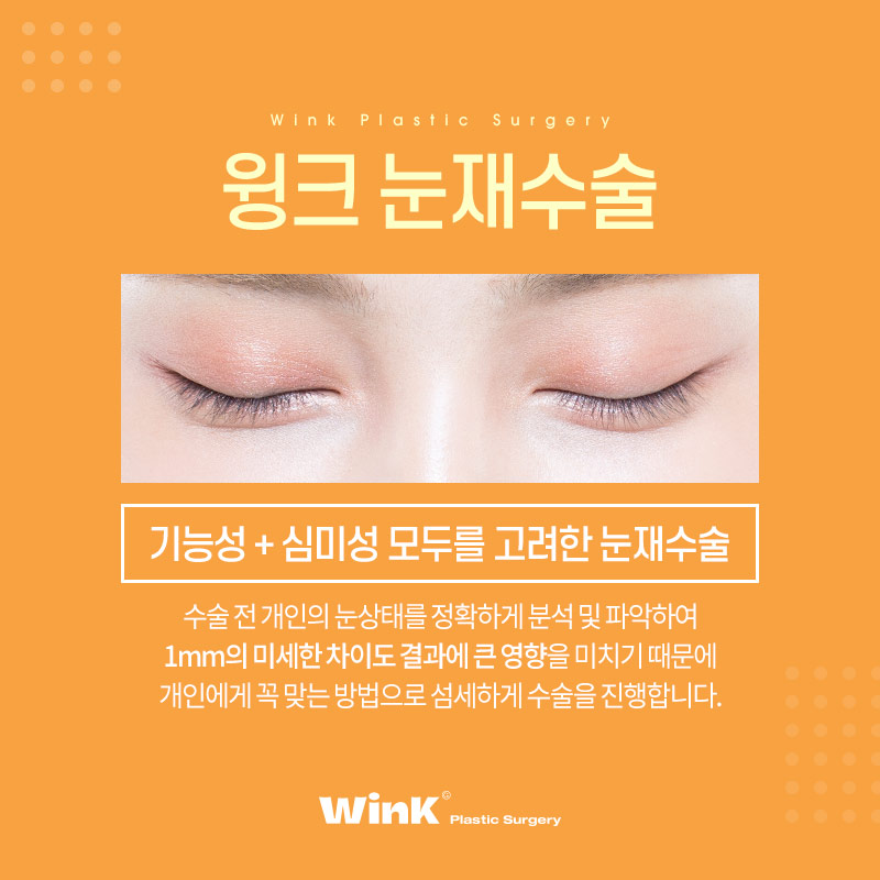 마지막 눈재수술을 위한 선택! 윙크성형외과 눈재수술 관련 이미지 5
