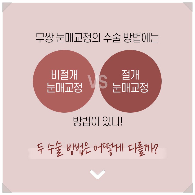 Epicanthoplasty-Free Ptosis Correction Surgery, Ptosis Surgery Without Double Eyelids, WINK Plastic Surgery, Ptosis Correction Surgery Before and After, Double Eyelid Ptosis Correction image 5