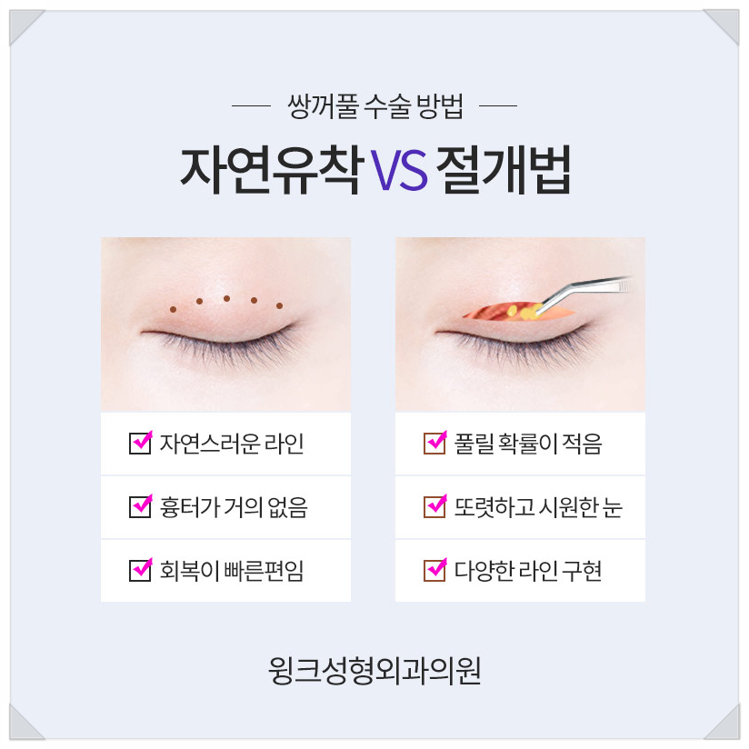 아이린눈 인아웃연예인?  윙크성형외과와 알아보는 쌍꺼풀라인종류! 관련 이미지 7