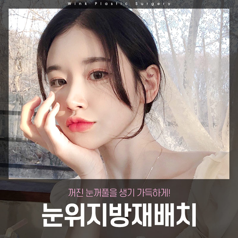 눈위 지방재배치에 대해 알아보겠습니다. 관련 이미지 1