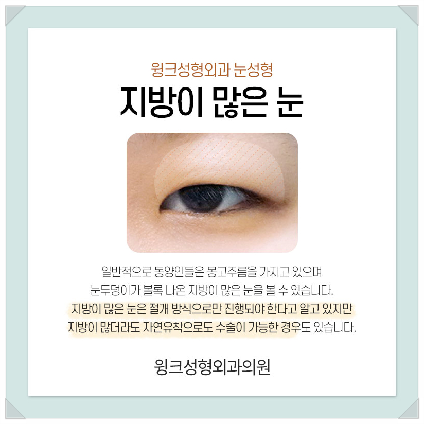 지방이많은눈 눈두덩이지방제거 절개쌍수비용을 알아보겠습니다. 관련 이미지 2
