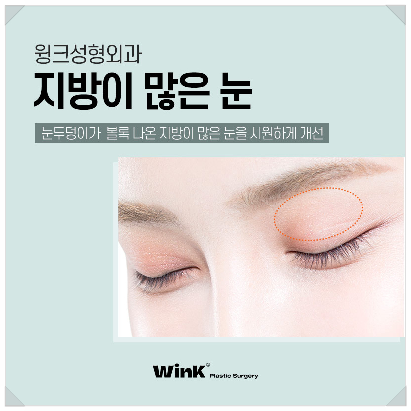 지방이많은눈 눈두덩이지방제거 절개쌍수비용을 알아보겠습니다. 관련 이미지 1