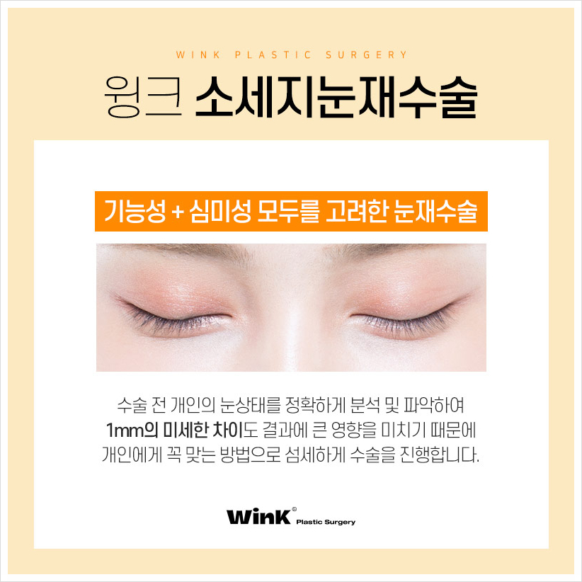Sausage Eyes After Double Eyelid Surgery: If You’re Concerned About a Bulky Double Eyelid, Wink Plastic Surgery’s Double Eyelid Line Lowering and Sausage Eye Revision Surgery Costs image 8
