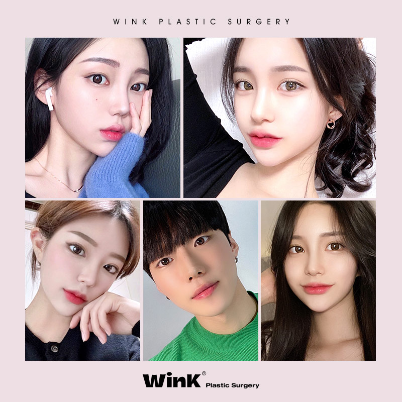 Elegant and Bright Eyes with Incisional Outer and Lower Canthoplasty at Wink Plastic Surgery! image 7