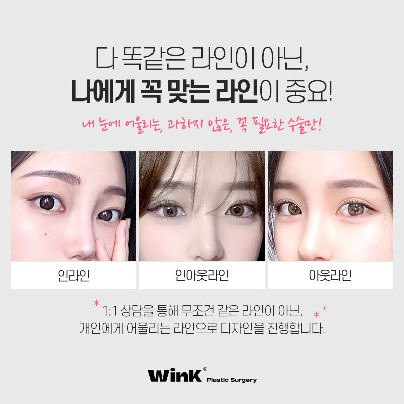 자연스럽게 예뻐지고 싶다면 윙크성형외과 자연유착쌍꺼풀! 관련 이미지 4