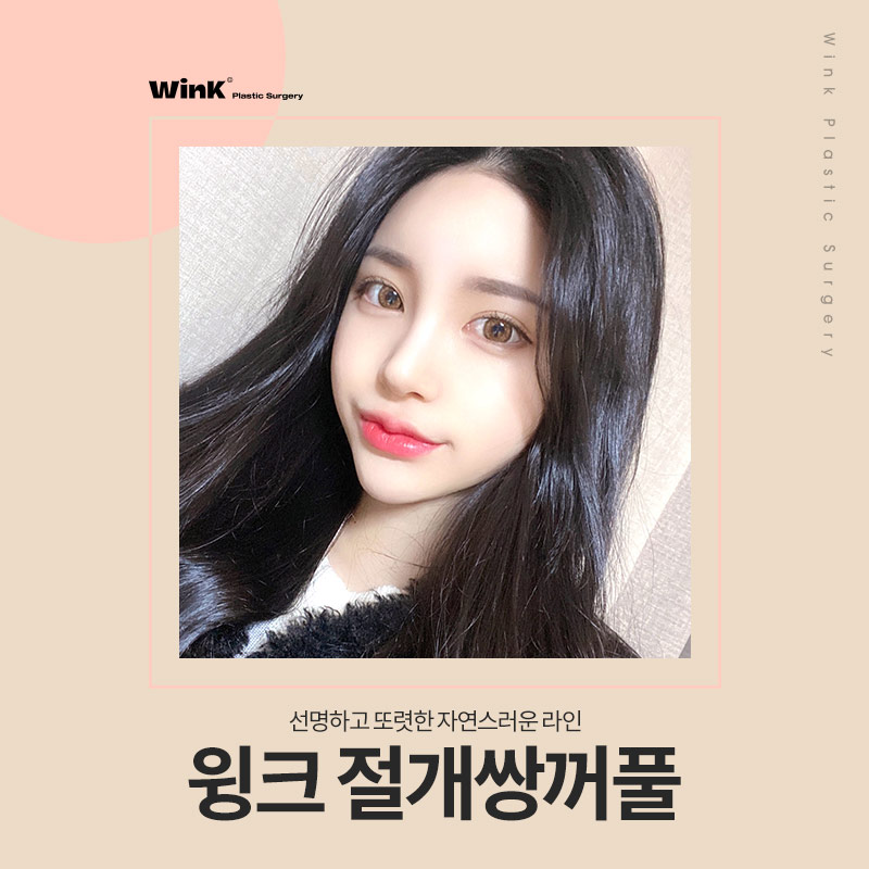Let’s Learn About Incisional Double Eyelid Surgery image 1