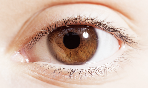 Double Eyelids: If You're Wondering Which Shape Will Suit You image 5