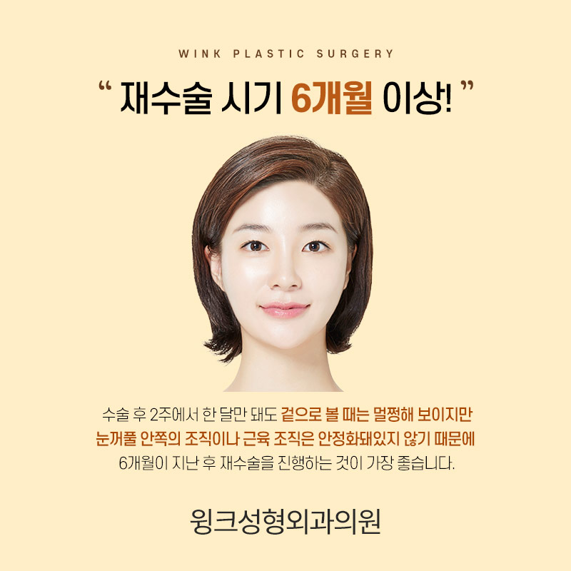 앞트임 복원 한달차 후기 관련 이미지 7