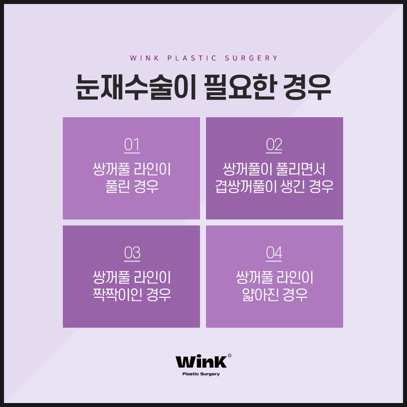 자연유착재수술 쌍수재수술 윙크성형외과 쌍꺼풀재수술 쌍꺼풀재수술후기 관련 이미지 3