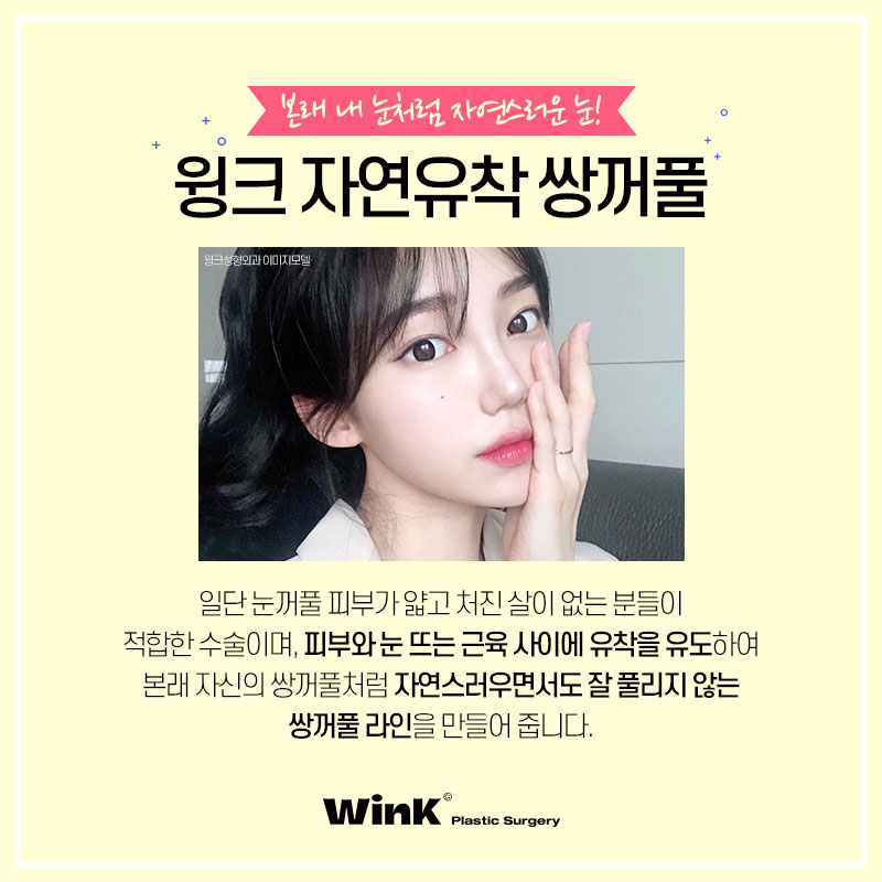 윙크성형외과 자연유착쌍꺼풀후기 쌍수잘하는곳 관련 이미지 2