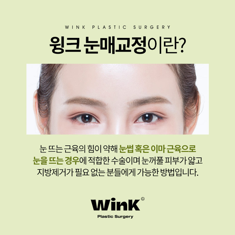 티나지 않는 또렷한 눈을 원한다면? 윙크 눈매교정 관련 이미지 2