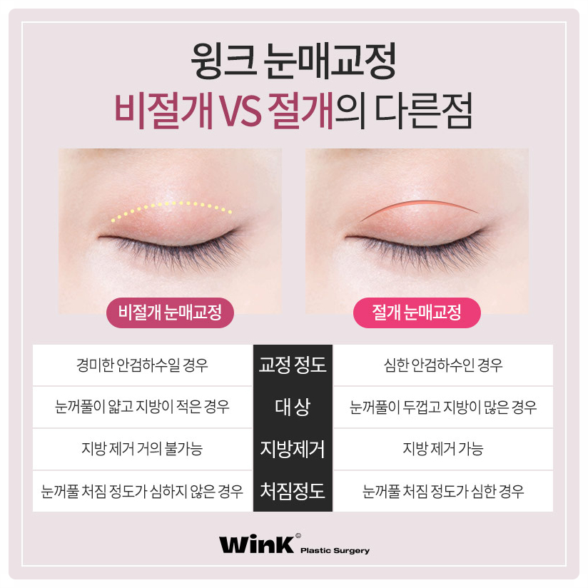 If you are looking into ptosis correction and double eyelid surgery before and after ptosis correction surgery at Sinsa Station, Wink Plastic Surgery image 3