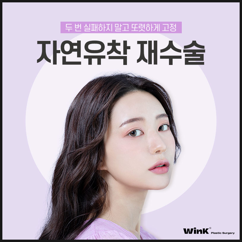 자연유착재수술 쌍수재수술 윙크성형외과 쌍꺼풀재수술 쌍꺼풀재수술후기 관련 이미지 1