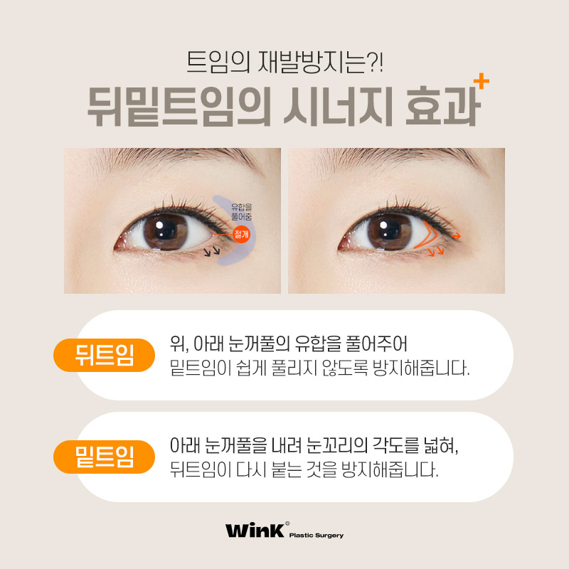 Does Lateral Canthoplasty Always Reattach? How to Minimize Side Effects of Lateral Canthoplasty, as Explained by Wink Plastic Surgery! image 5