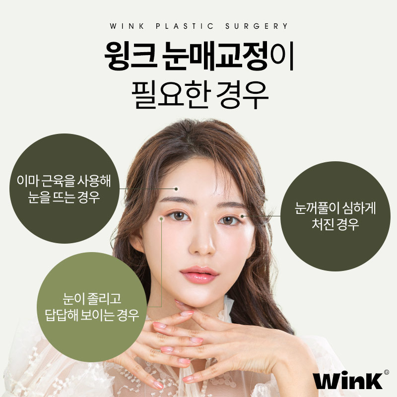 티나지 않는 또렷한 눈을 원한다면? 윙크 눈매교정 관련 이미지 3