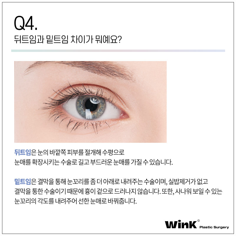 윙크성형외과에서 알려드리는 트임에 관한 모든 것! 관련 이미지 6