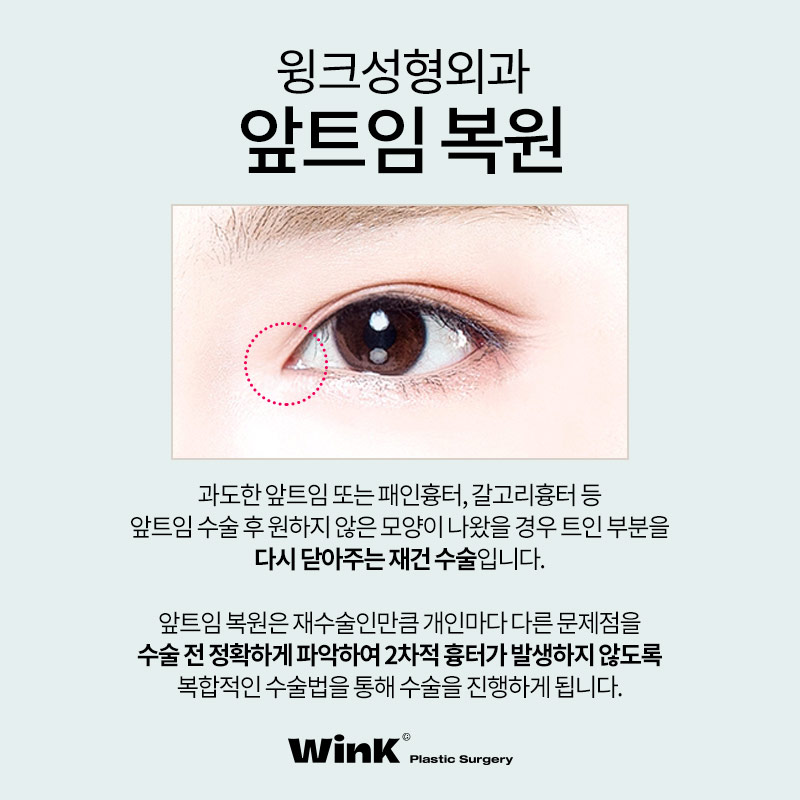 신사역앞트임복원 윙크성형외과  앞트임복원후기 알아보자! 관련 이미지 2