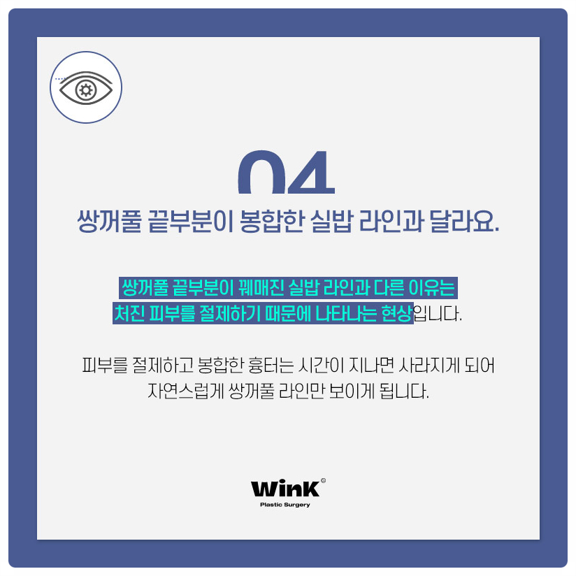 Post-Double Eyelid Surgery Care Methods: Follow the Guidance from Wink Plastic Surgery! Swelling After Double Eyelid Surgery image 5