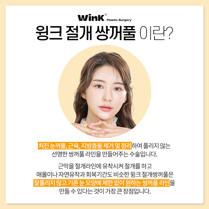 신사절개쌍꺼풀 쌍수절개후기 윙크성형외과 절개쌍꺼풀 관련 이미지 3
