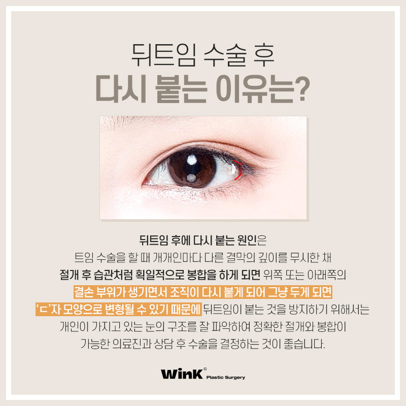 Does Lateral Canthoplasty Always Reattach? How to Minimize Side Effects of Lateral Canthoplasty, as Explained by Wink Plastic Surgery! image 2