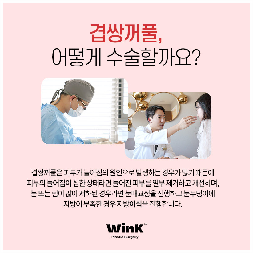 겹주름쌍꺼풀 겹쌍 쌍꺼풀여러겹 겹쌍꺼풀수술은 윙크성형외과! 관련 이미지 4