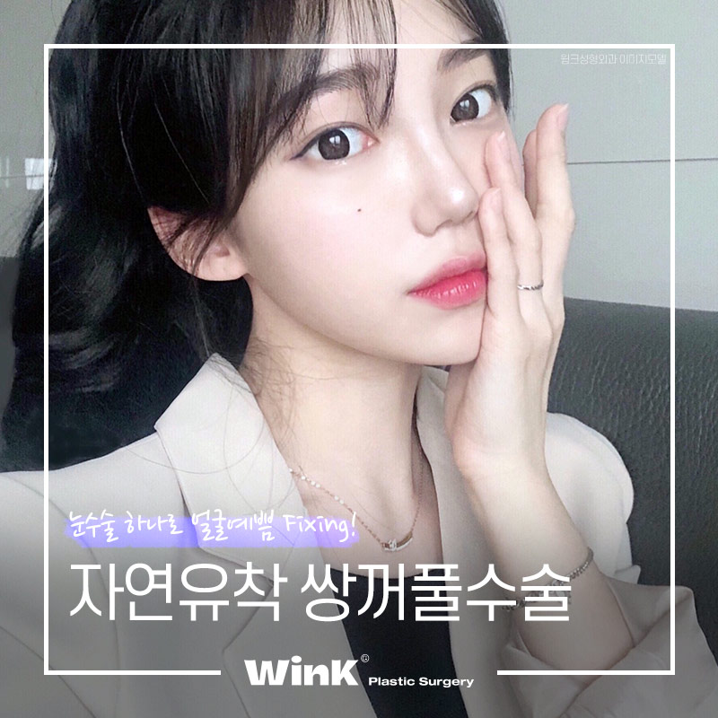 신사역쌍수잘하는곳? 윙크성형외과 자연유착쌍꺼풀후기 관련 이미지 7