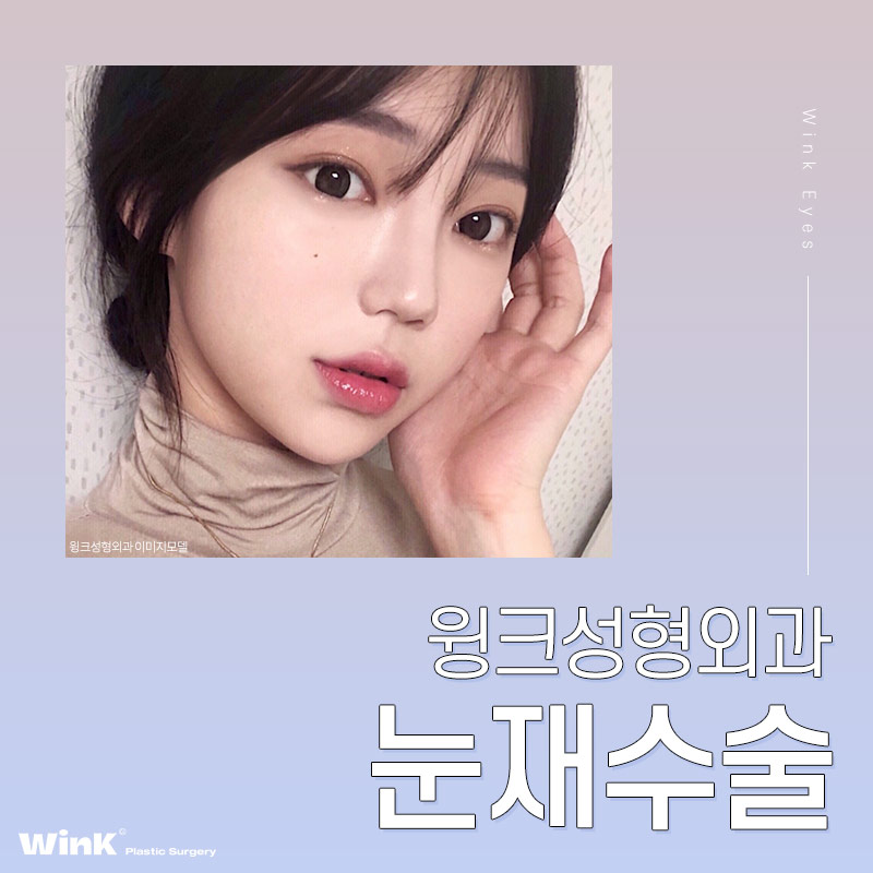 마지막 눈재수술을 위한 선택! 윙크성형외과 눈재수술 관련 이미지 1