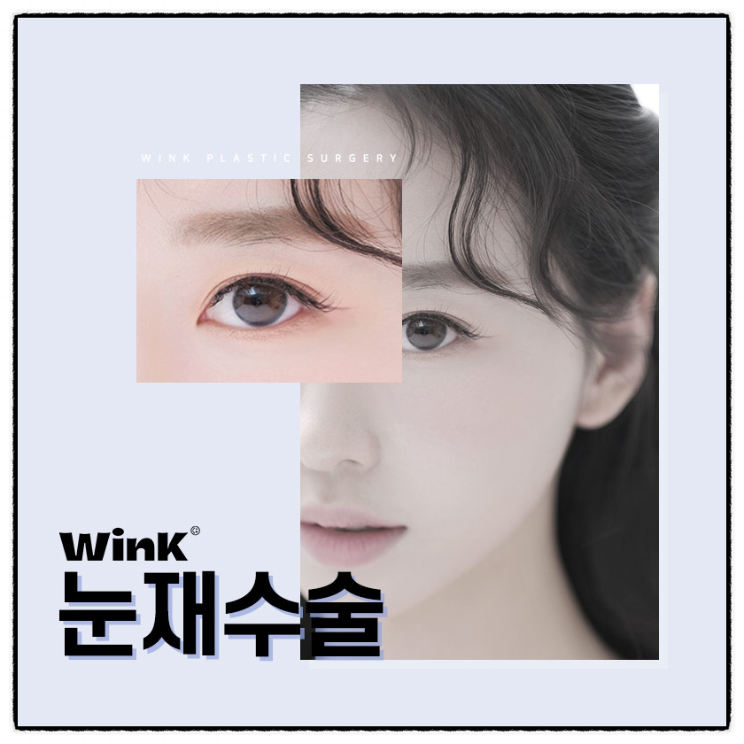쌍꺼풀절개재수술 절개쌍수재수술후기로 흉터부터 회복까지 알아보자! 관련 이미지 1