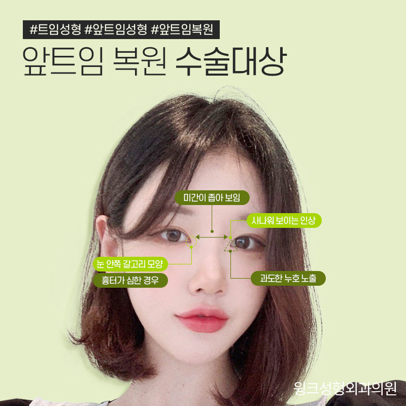 트임복원) 과도하게 트인 앞트임부작용을 앞트임복원으로 깔끔하고 자연스러운 결과 관련 이미지 2