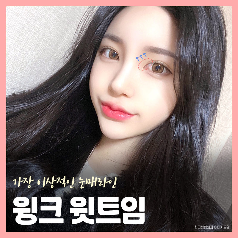 섬세하게 들어올려 또렷한 윙크윗트임 윗트임후기 윗트임잘하는곳 신사윗트임가격 관련 이미지 3
