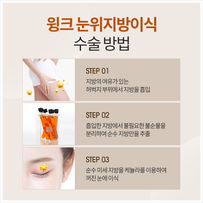 꺼진눈지방이식후기 눈두덩이지방이식 윙크성형외과 눈꺼풀꺼짐수술 관련 이미지 5