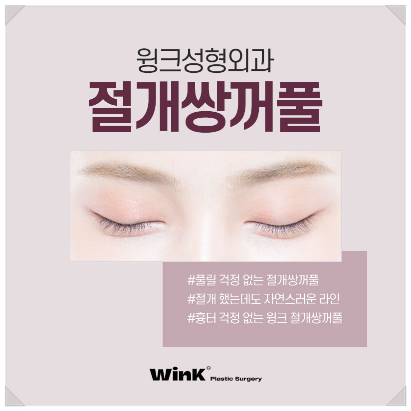 Incisional Double Eyelid Surgery: A Natural Line Without Worrying About Scars Even After Surgery! image 1