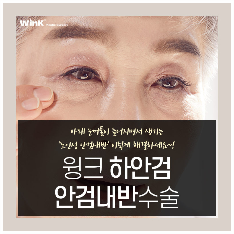 Lower Eyelid Entropion, Eyelashes Poking the Eye, Wink Plastic Surgery, Before and After Entropion Surgery image 1