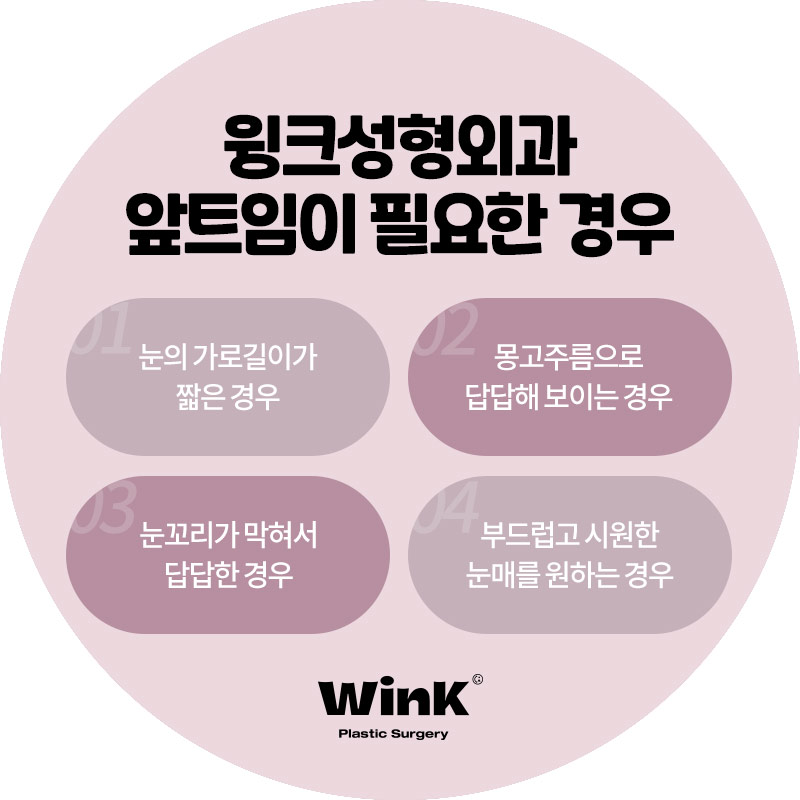 윙크성형외과 앞트임 답답한 눈매를 시원하게 관련 이미지 6