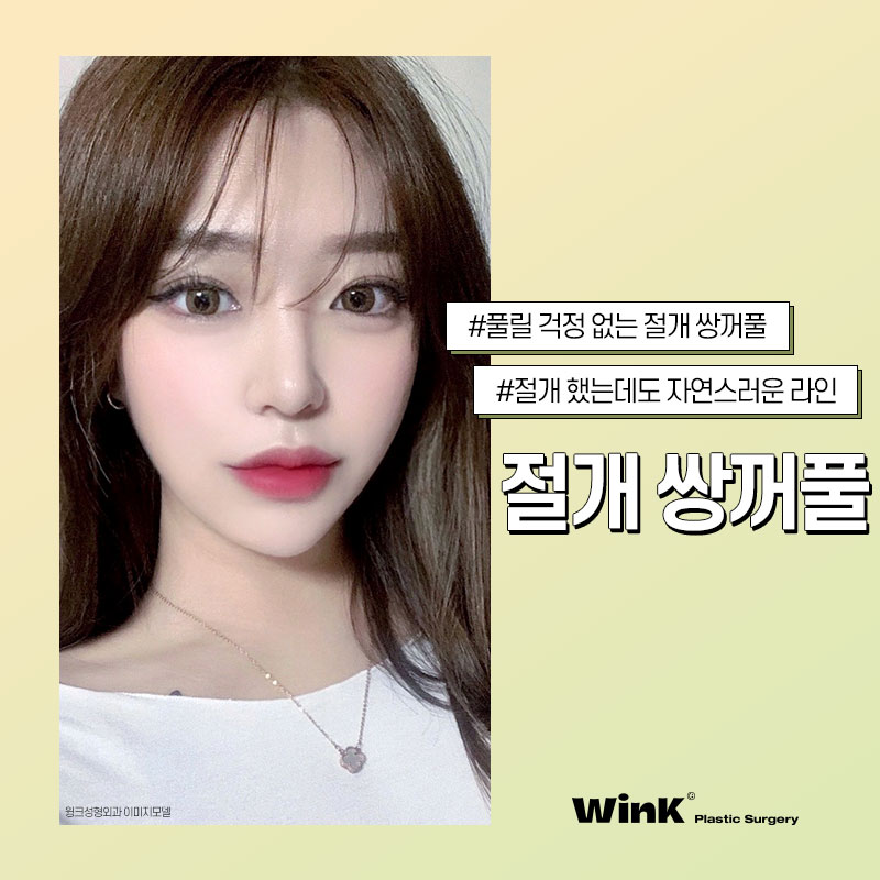 풀릴 걱정 없는 윙크성형외과 절개쌍꺼풀 관련 이미지 1
