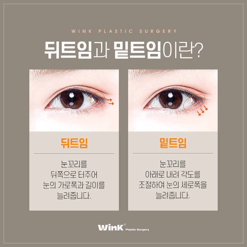 Does Lateral Canthoplasty Always Reattach? How to Minimize Side Effects of Lateral Canthoplasty, as Explained by Wink Plastic Surgery! image 4