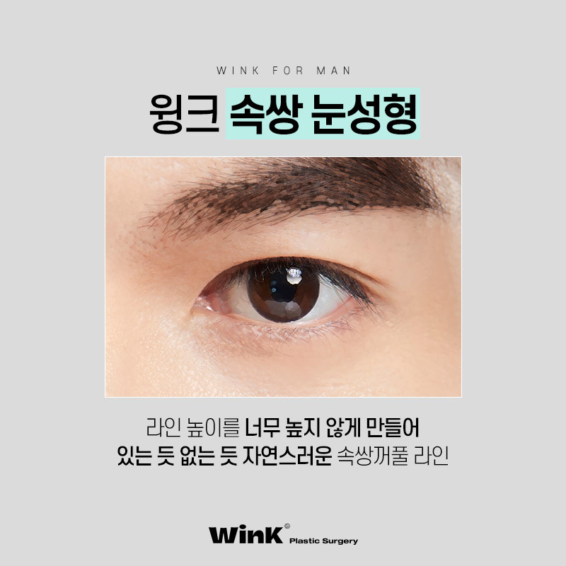 Sinsa Station Male Eye Surgery, What Kind of Eyes Suit Me? image 5